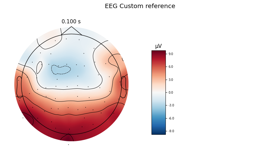 EEG Custom reference, 0.100 s, µV