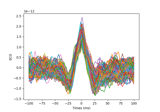 Find ECG artifacts