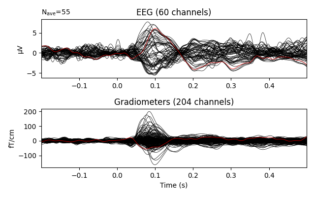 EEG (60 channels), Gradiometers (204 channels)