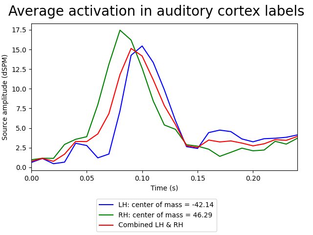 Average activation in auditory cortex labels