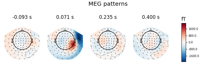 MEG patterns, -0.093 s, 0.071 s, 0.235 s, 0.400 s, fT