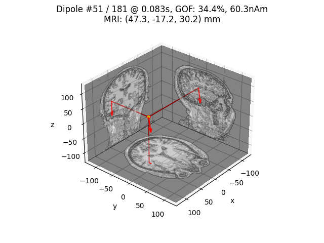 Dipole #51 / 181 @ 0.083s, GOF: 34.4%, 60.3nAm MRI: (47.3, -17.2, 30.2) mm