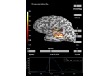 The :class:`SourceEstimate <mne.SourceEstimate>` data structure