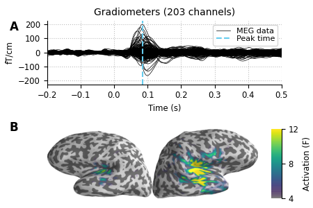 Gradiometers (203 channels)
