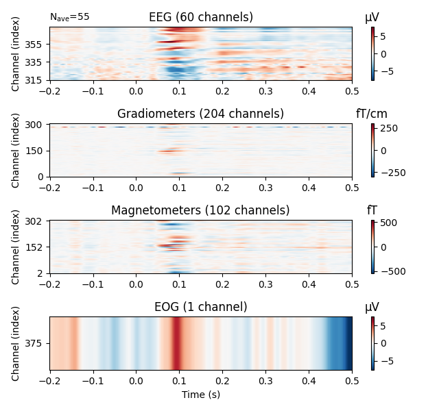EEG (60 channels), Gradiometers (204 channels), Magnetometers (102 channels), EOG (1 channel), µV, fT/cm, fT, µV