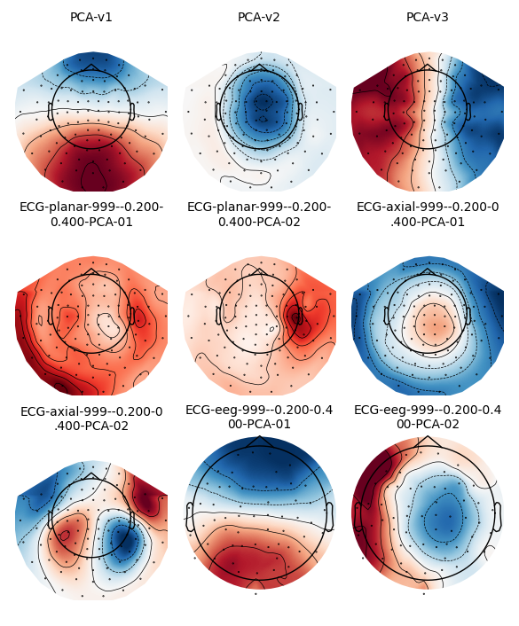 PCA-v1, PCA-v2, PCA-v3, ECG-planar-999--0.200- 0.400-PCA-01, ECG-planar-999--0.200- 0.400-PCA-02, ECG-axial-999--0.200-0 .400-PCA-01, ECG-axial-999--0.200-0 .400-PCA-02, ECG-eeg-999--0.200-0.4 00-PCA-01, ECG-eeg-999--0.200-0.4 00-PCA-02