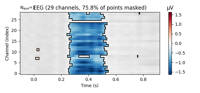 EEG (29 channels, 75.8% of points masked), µV
