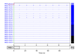 Simulate raw data using subject anatomy