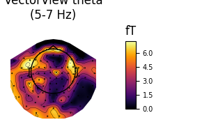 VectorView theta (5-7 Hz), fT