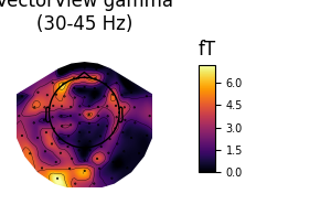 VectorView gamma (30-45 Hz), fT