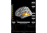 2 samples permutation test on source data with spatio-temporal clustering