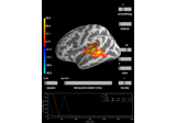 Permutation t-test on source data with spatio-temporal clustering