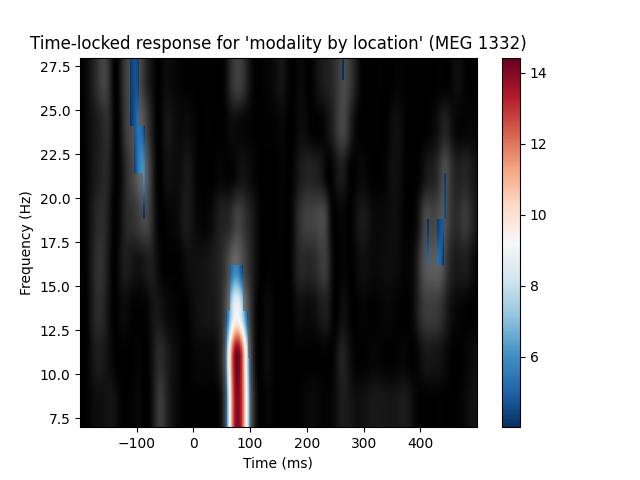 Time-locked response for 'modality by location' (MEG 1332)