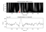 Non-parametric between conditions cluster statistic on single trial power