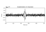 Time-frequency on simulated data (Multitaper vs. Morlet vs. Stockwell)