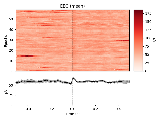 EEG (mean)