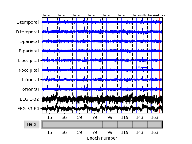 plot 20 visualize epochs