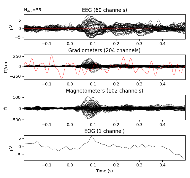 EEG (60 channels), Gradiometers (204 channels), Magnetometers (102 channels), EOG (1 channel)