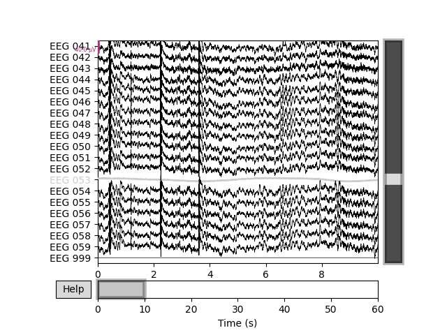 plot 55 setting eeg reference