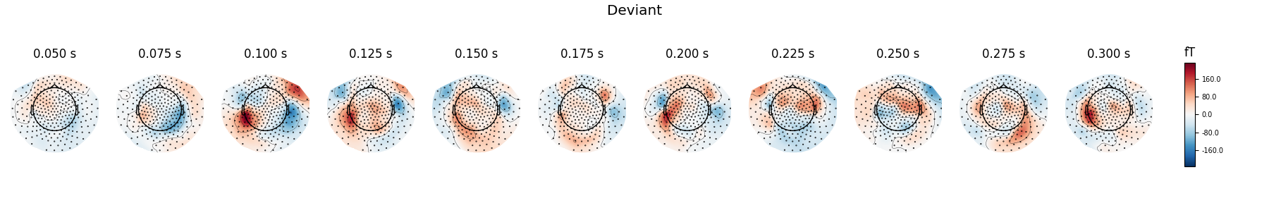 Deviant, 0.050 s, 0.075 s, 0.100 s, 0.125 s, 0.150 s, 0.175 s, 0.200 s, 0.225 s, 0.250 s, 0.275 s, 0.300 s, fT