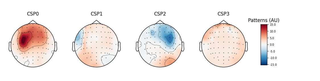 CSP0, CSP1, CSP2, CSP3, Patterns (AU)