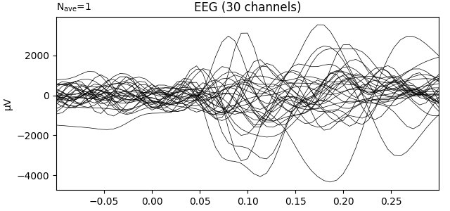 EEG (30 channels)