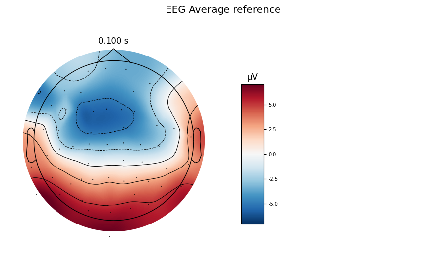 EEG Average reference, 0.100 s, µV