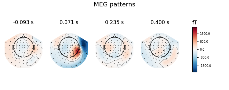 MEG patterns, -0.093 s, 0.071 s, 0.235 s, 0.400 s, fT