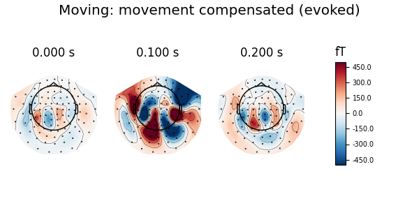 Moving: movement compensated (evoked), 0.000 s, 0.100 s, 0.200 s, fT