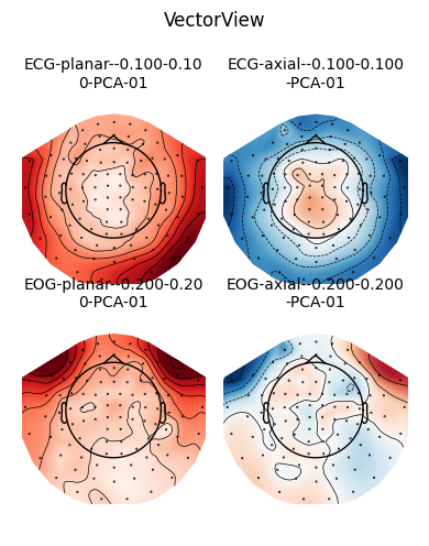 VectorView, ECG-planar--0.100-0.10 0-PCA-01, ECG-axial--0.100-0.100 -PCA-01, EOG-planar--0.200-0.20 0-PCA-01, EOG-axial--0.200-0.200 -PCA-01