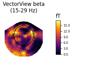 VectorView beta (15-29 Hz), fT