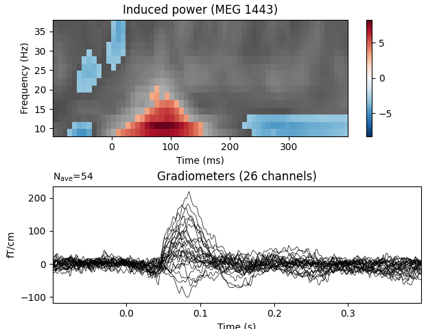 Induced power (MEG 1443), Gradiometers (26 channels)