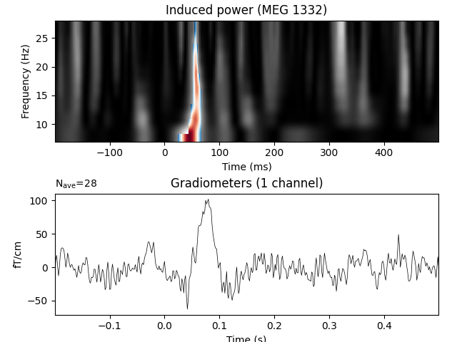 Induced power (MEG 1332), Gradiometers (1 channel)