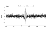 Time-frequency on simulated data (Multitaper vs. Morlet vs. Stockwell)