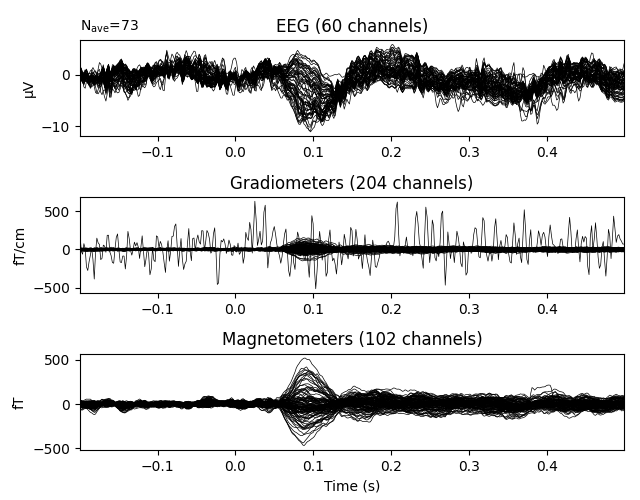 EEG (60 channels), Gradiometers (204 channels), Magnetometers (102 channels)