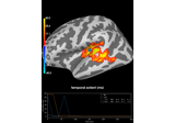 Permutation t-test on source data with spatio-temporal clustering