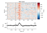 Visualizing epoched data