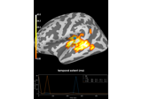 2 samples permutation test on source data with spatio-temporal clustering