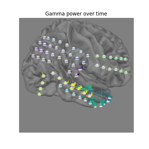 Gamma power over time