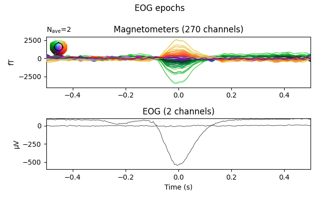 EOG epochs, Magnetometers (270 channels), EOG (2 channels)