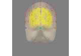 EEG forward operator with a template MRI