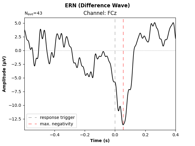 ERN (Difference Wave), Channel: FCz