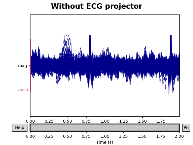 Without ECG projector