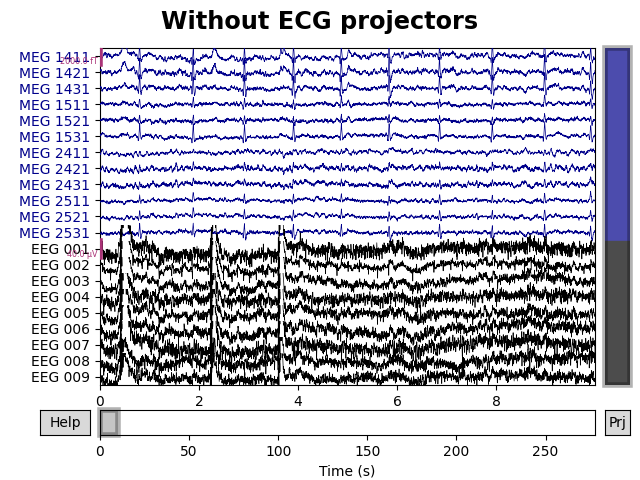 Without ECG projectors