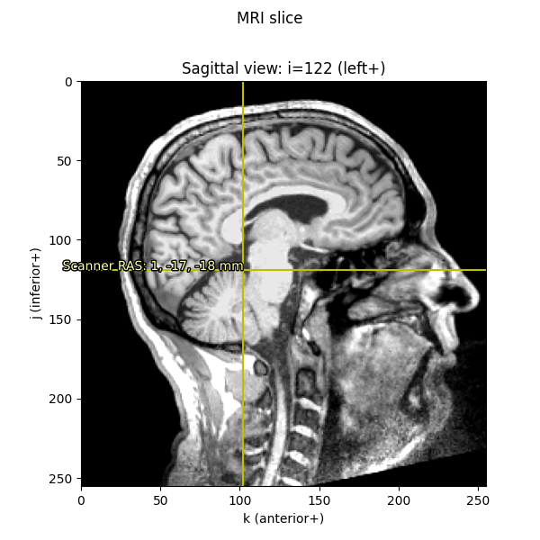 MRI slice, Sagittal view: i=122 (left+)