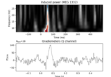 Non-parametric between conditions cluster statistic on single trial power