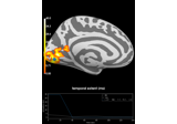 Repeated measures ANOVA on source data with spatio-temporal clustering