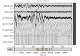 Sleep stage classification from polysomnography (PSG) data