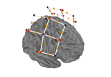 Preprocessing functional near-infrared spectroscopy (fNIRS) data