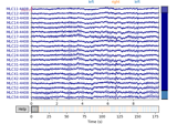 Brainstorm raw (median nerve) dataset